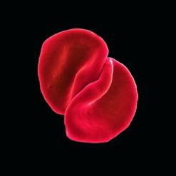 Peter Gabriel — My Body Is A Cage